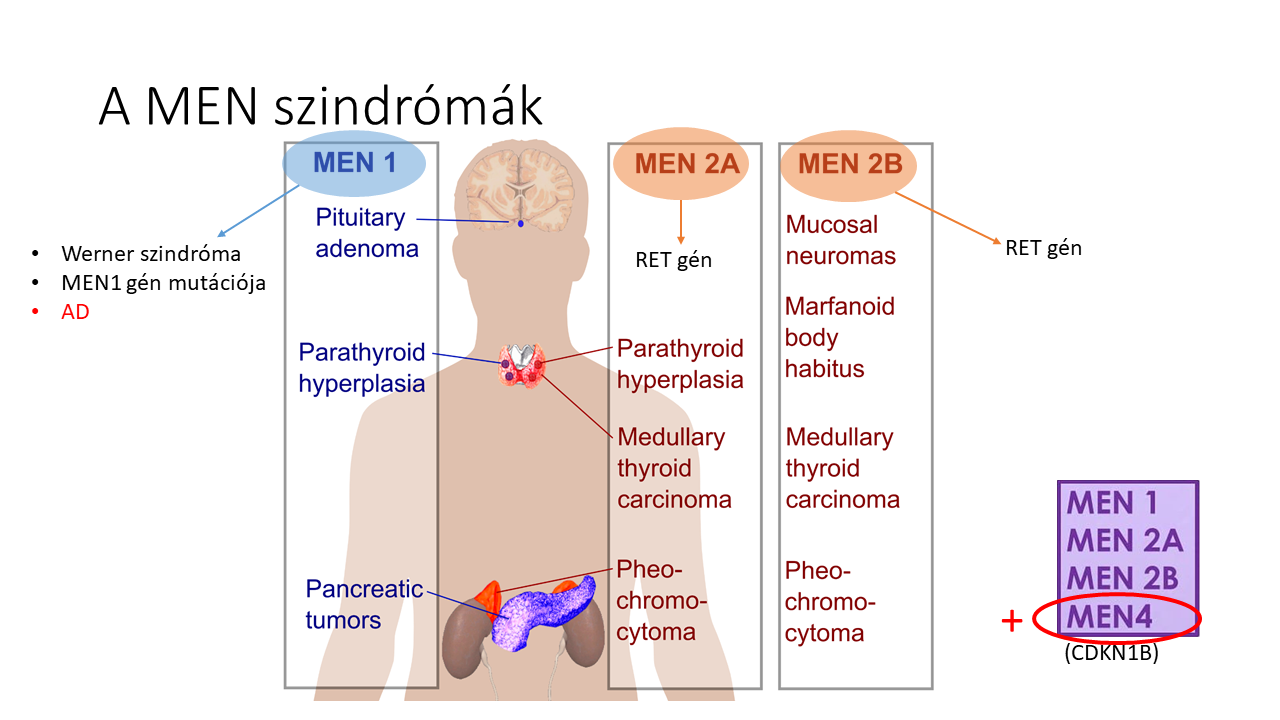 MEN szindrómák tünetei